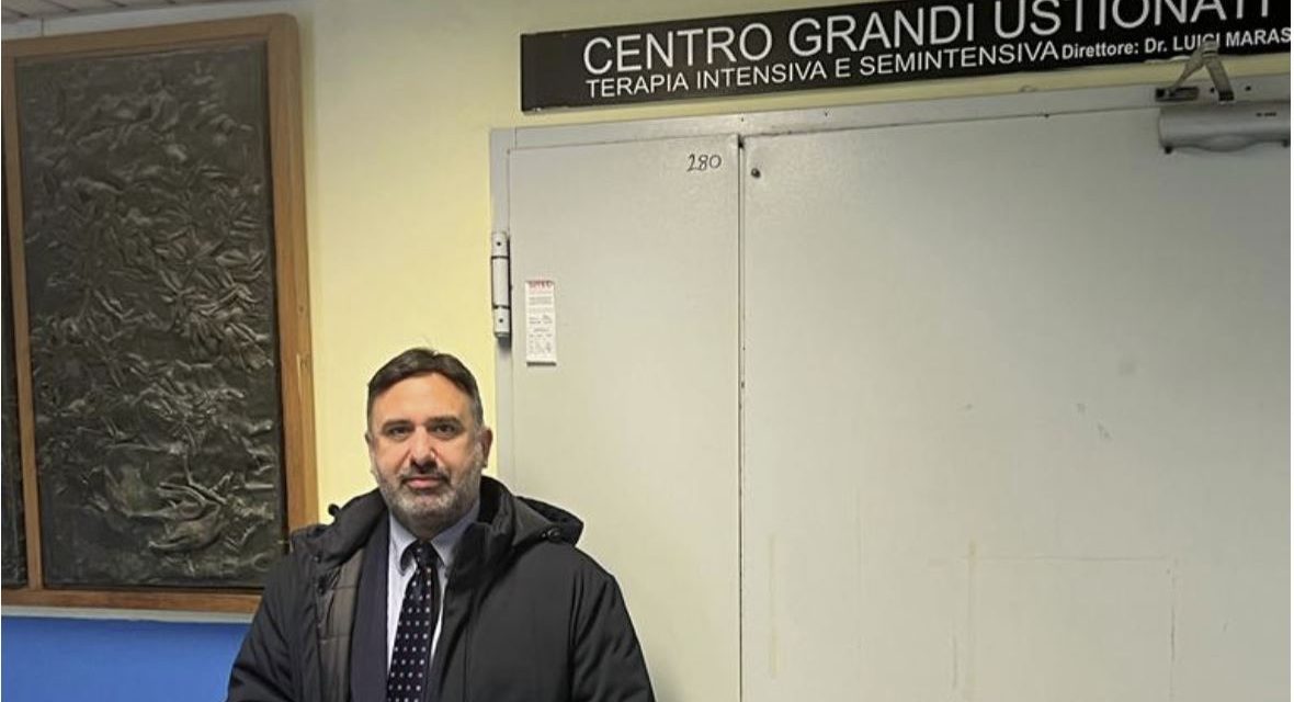 Presidente della Commissione Sanità  Mauro Vizzino in visita al il Centro Grandi Ustionati del Perrino