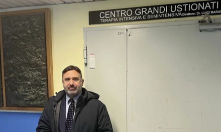 Presidente della Commissione Sanità  Mauro Vizzino in visita al il Centro Grandi Ustionati del Perrino