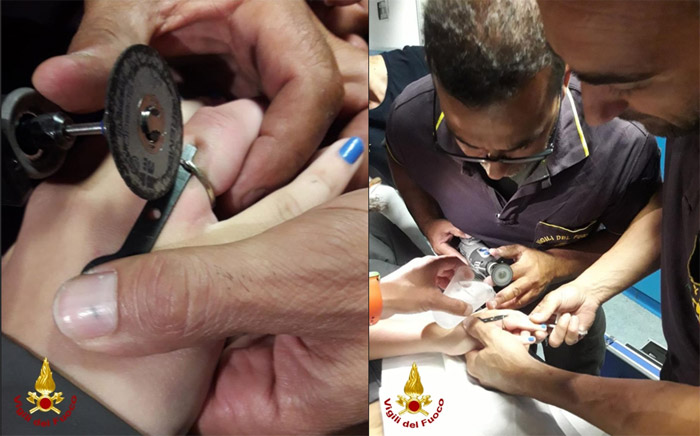 Vigili del Fuoco, intervento nell’Ospedale “Perrino” di Brindisi per rimuovere l’anello incastrato sul dito di una bambina